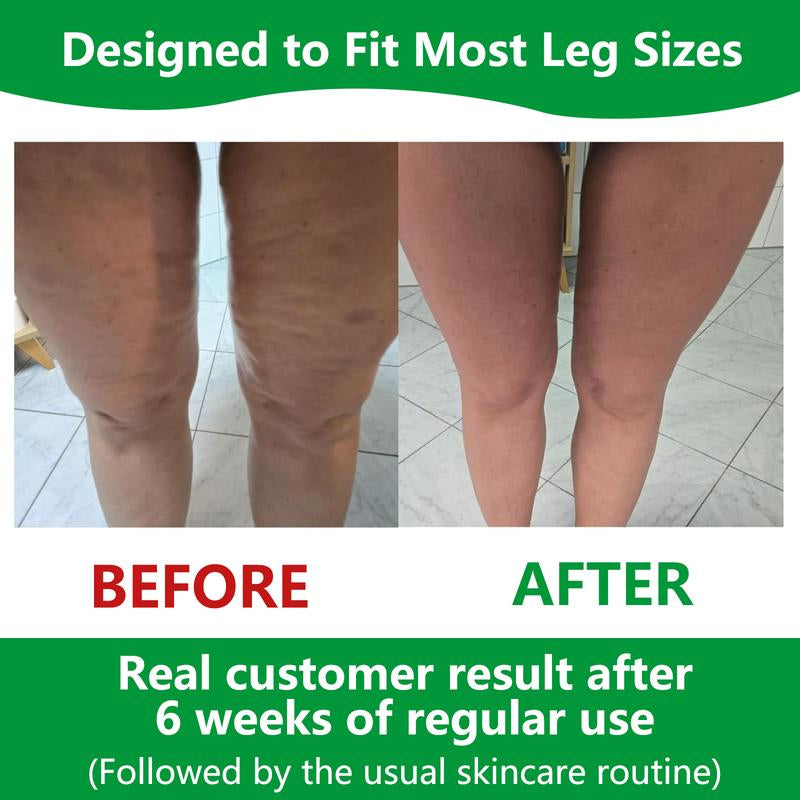 Cellulite Manual Push-Pull Roller - Thigh, Calf, Waist Push-Pull Tool - Deep Tissue Pain Relief, Body Sculpting, Anti-Inflammation and Fast Recovery