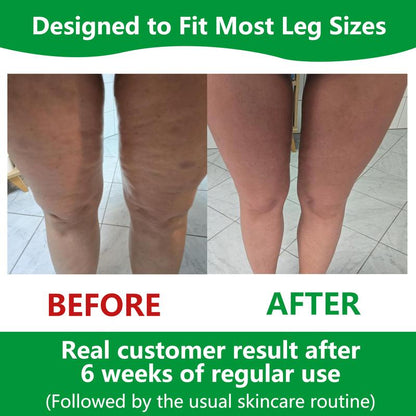 Cellulite Manual Push-Pull Roller - Thigh, Calf, Waist Push-Pull Tool - Deep Tissue Pain Relief, Body Sculpting, Anti-Inflammation and Fast Recovery